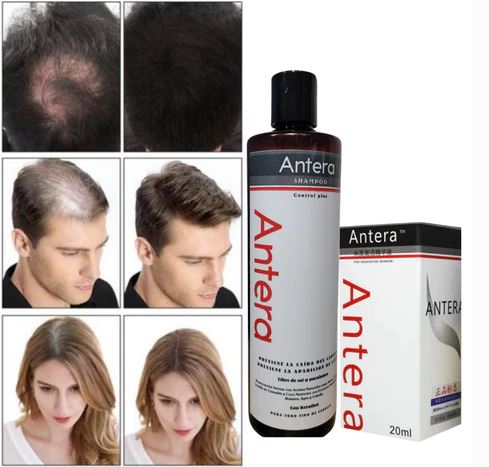 ANTERA TONICO CRECEPELO®️⭐⭐⭐⭐⭐ ORIGINAL