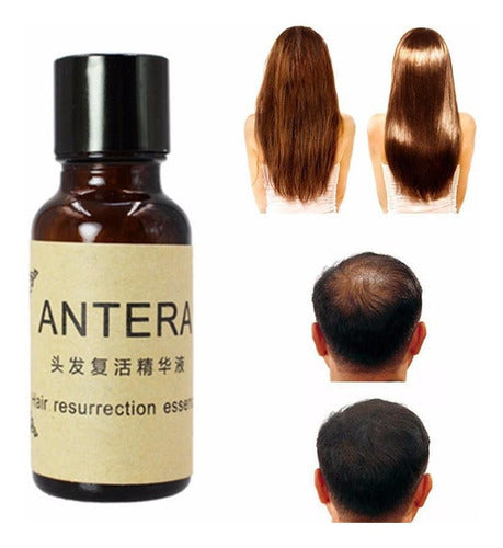 ANTERA TONICO CRECEPELO®️⭐⭐⭐⭐⭐ ORIGINAL